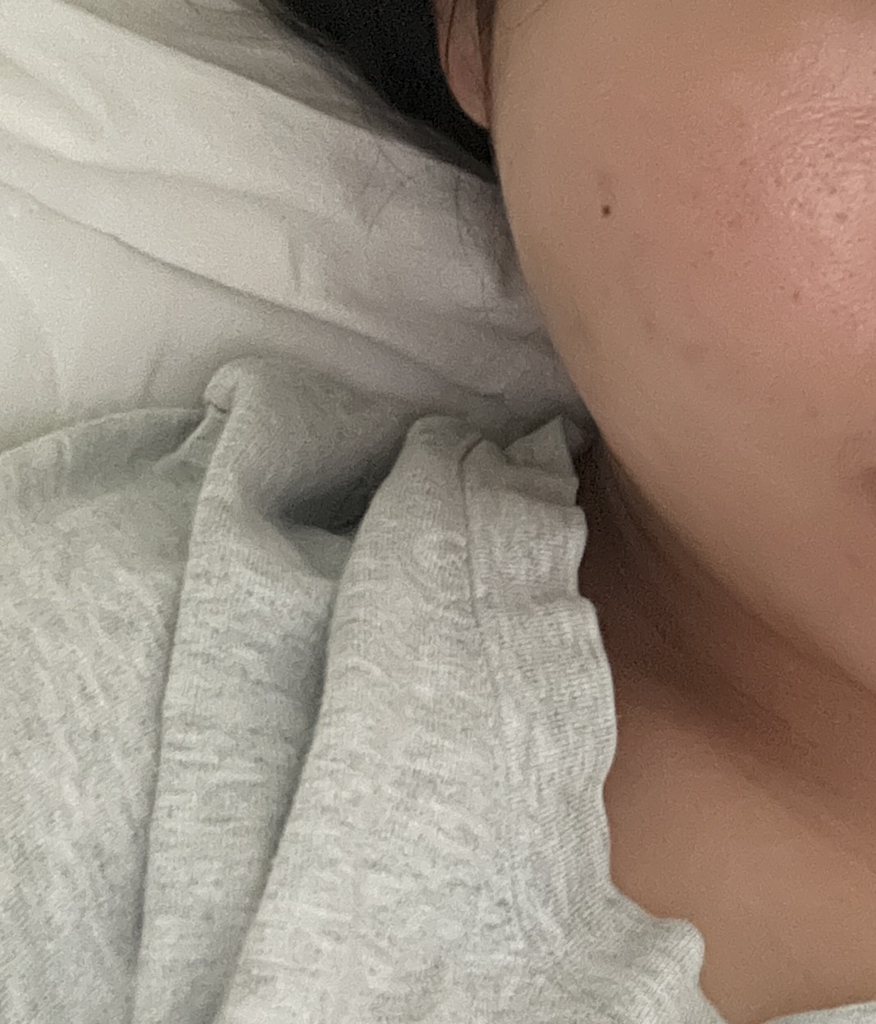 후시다인 (Fusidyne) 더마 트러블 징크 카밍 선크림 [SPF50+/PA++++] review image