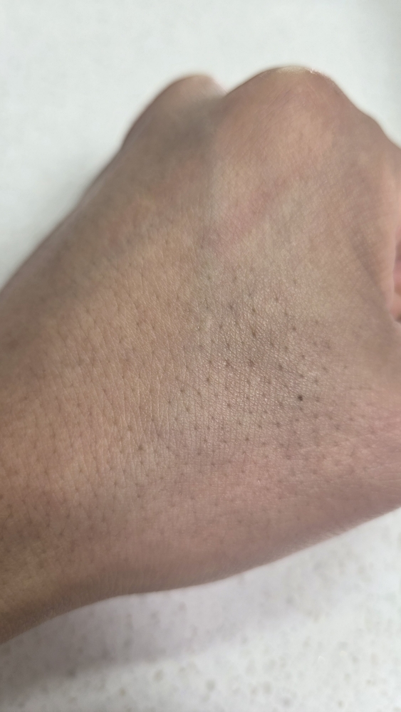 舒缓霜的真实用户使用照片