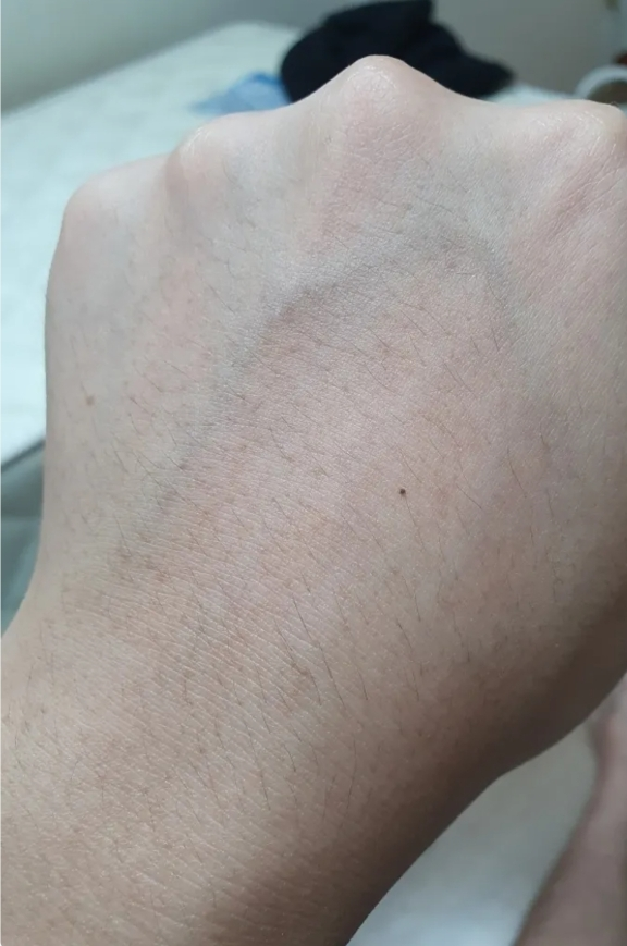 에센허브 (essenHERB) 티트리 안티 세범 딥 클렌징 오일 review image