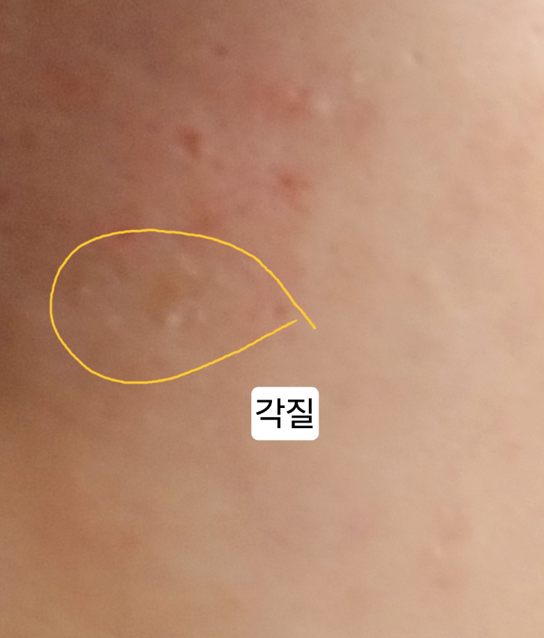 绿豆牛奶去角质凝胶的真实用户使用照片