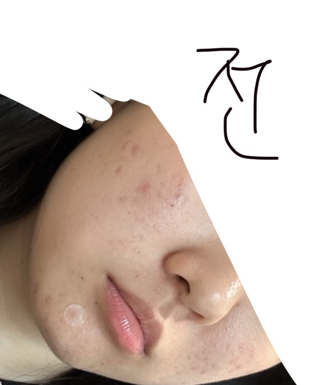 梵蒂爱诺 北卡罗来纳州问题追踪安瓿 common.review image