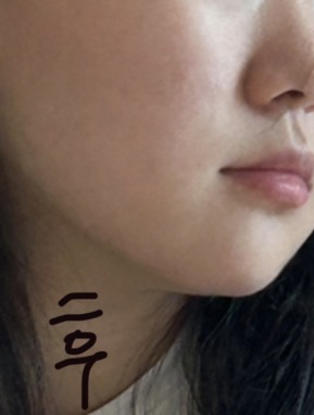 파티온 (FATION) 노스카나인 트러블 흔적 앰플 review image