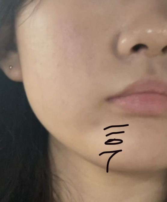 파티온 (FATION) 노스카나인 트러블 흔적 앰플 review image