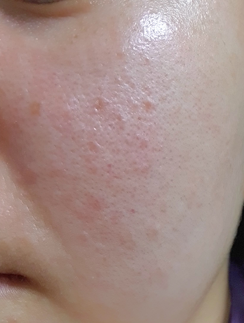 红色冰沙精华 30的真实用户使用照片
