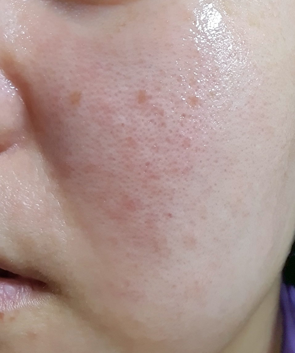 红色冰沙精华 30的真实用户使用照片