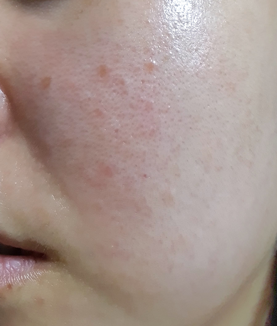 红色冰沙精华 30的真实用户使用照片