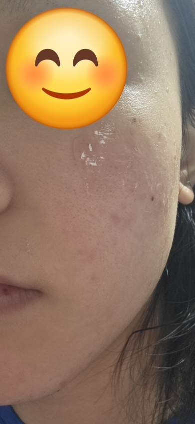 红色冰沙精华 30的真实用户使用照片