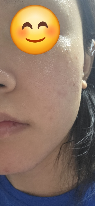 红色冰沙精华 30的真实用户使用照片