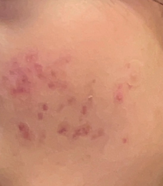 브이티코스메틱 (VTCOSMETICS) 리들샷 300 review image