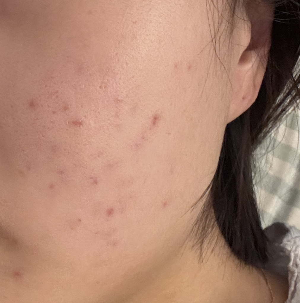 브이티코스메틱 (VTCOSMETICS) 리들샷 300 review image