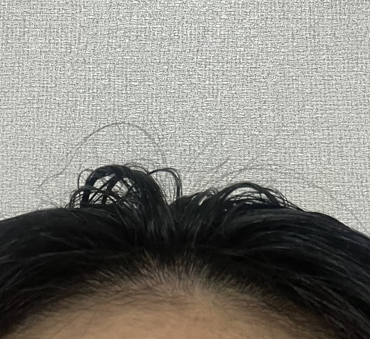 리필드 (Refilled) 사이토카인 부스터 [프로] review image