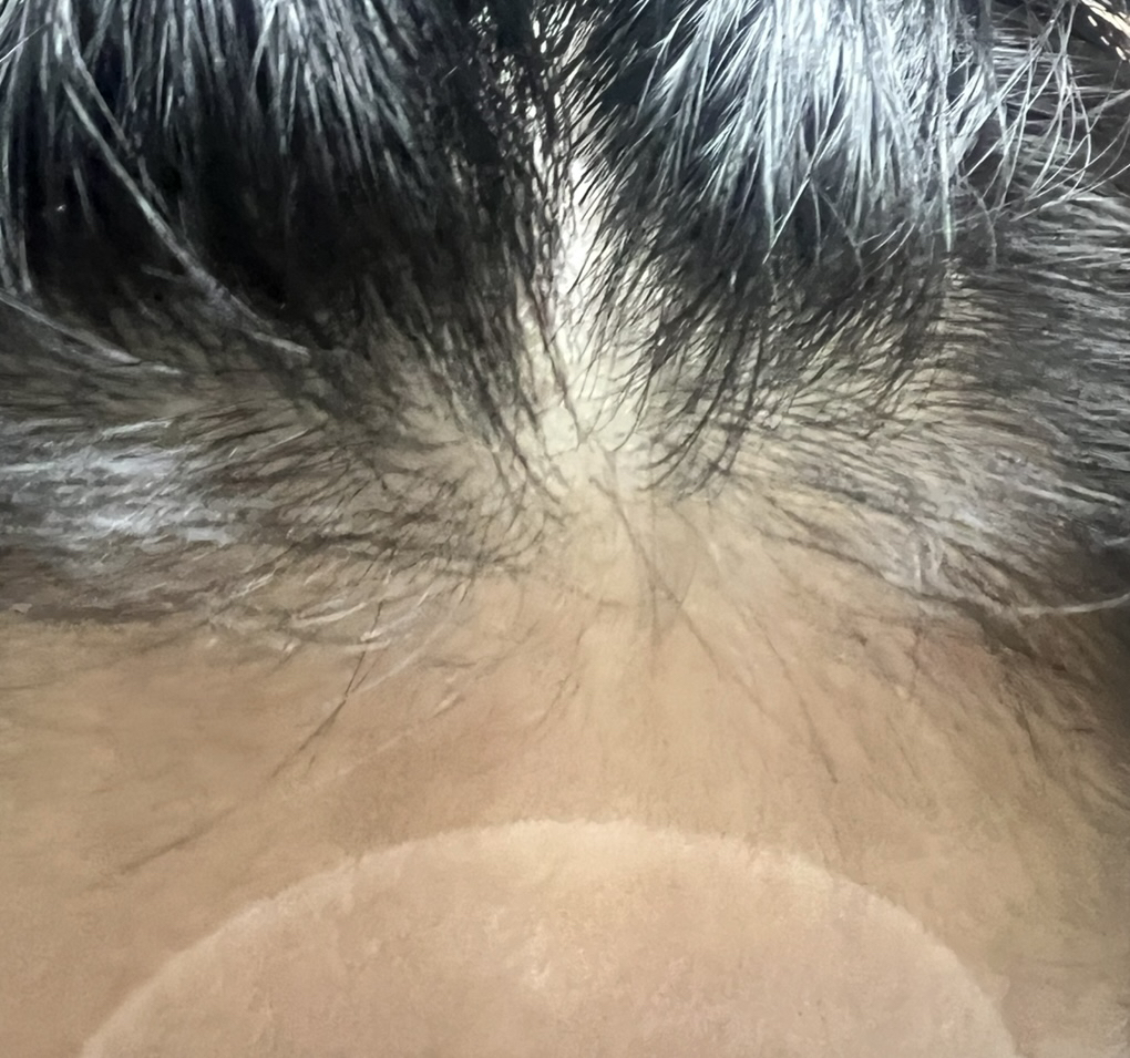 리필드 (Refilled) 사이토카인 부스터 [프로] review image