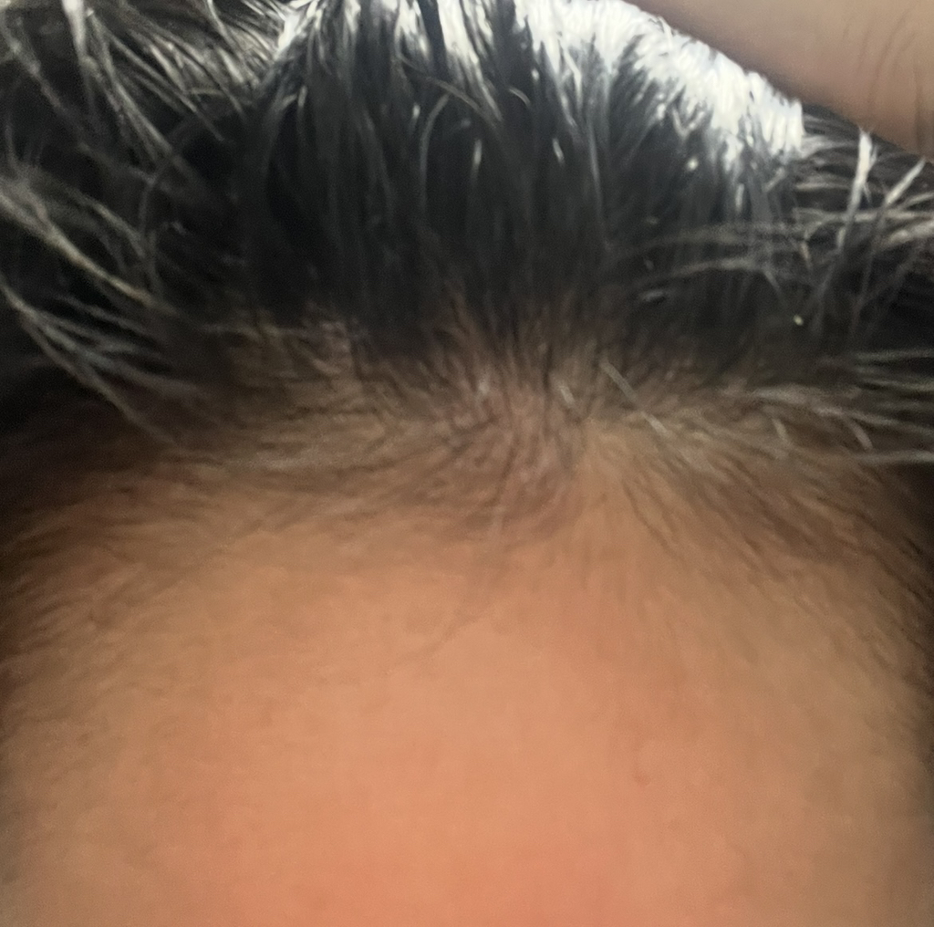 리필드 (Refilled) 사이토카인 부스터 [프로] review image