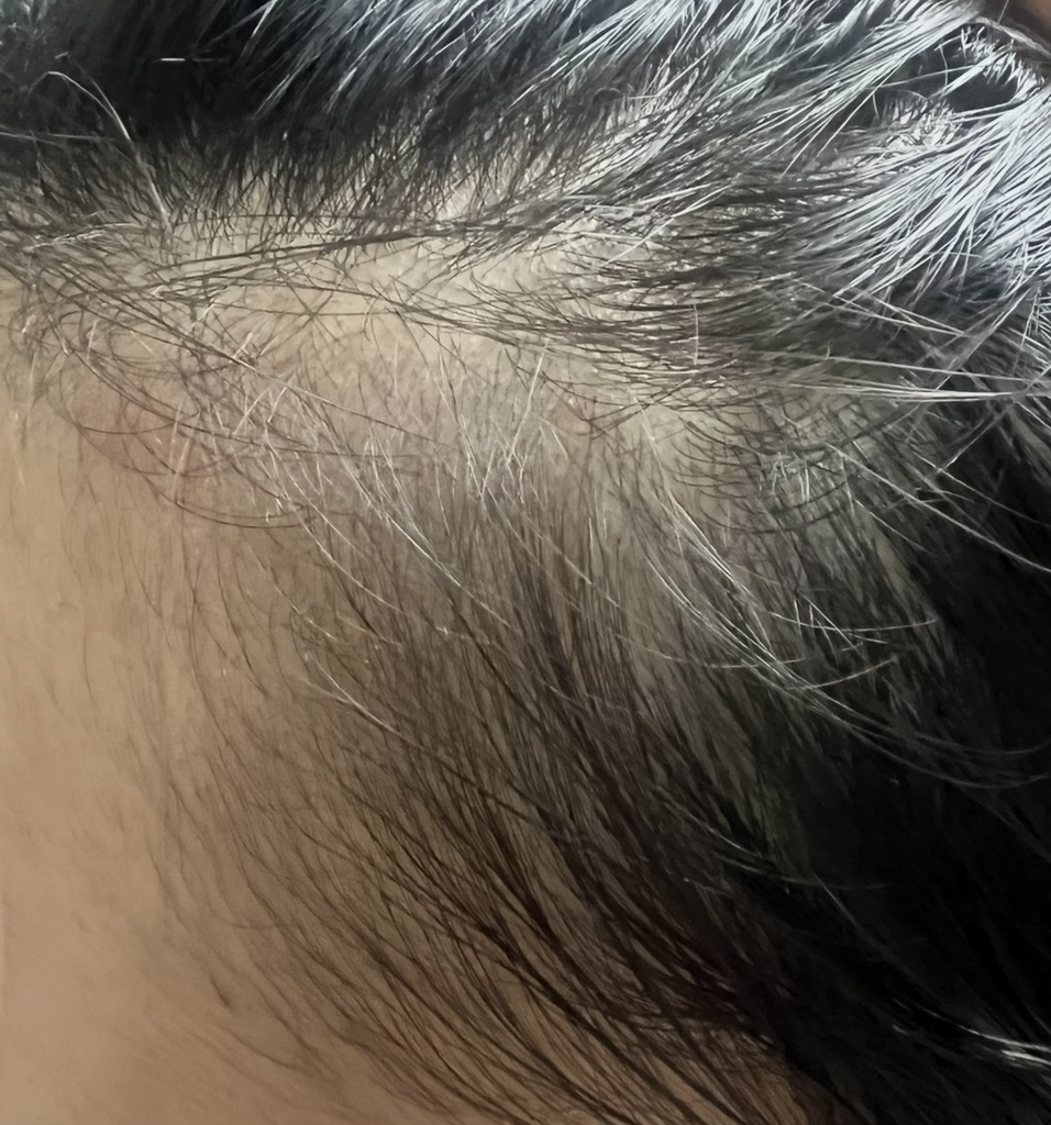 리필드 (Refilled) 사이토카인 부스터 [프로] review image