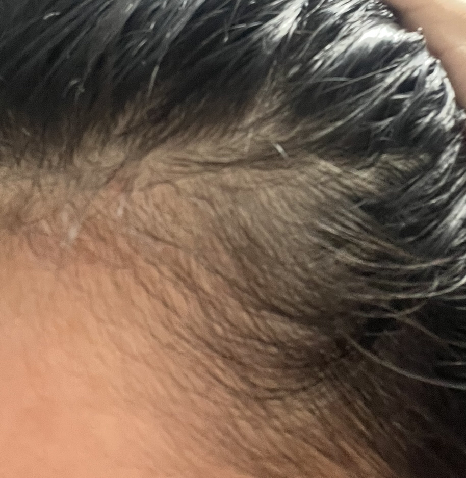 리필드 (Refilled) 사이토카인 부스터 [프로] review image