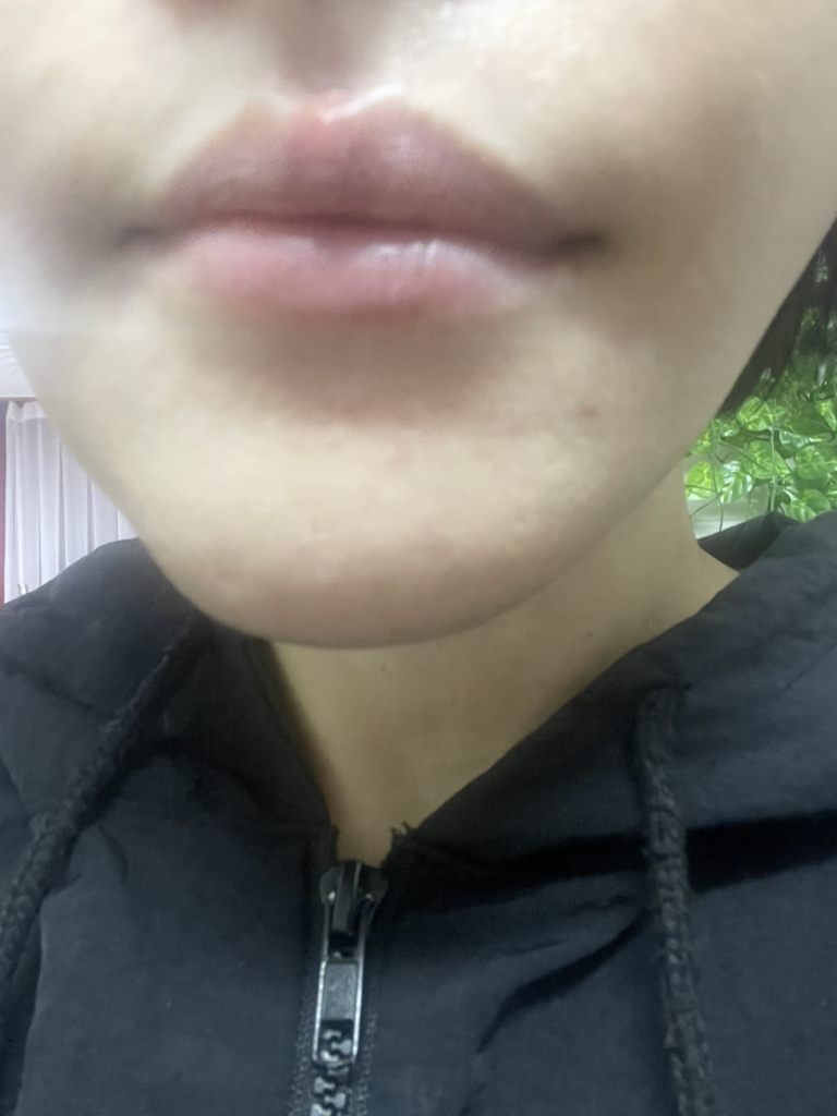 센텔리안24 (CENTELLIAN24) 마데카 분말 티트리 에이씨 review image