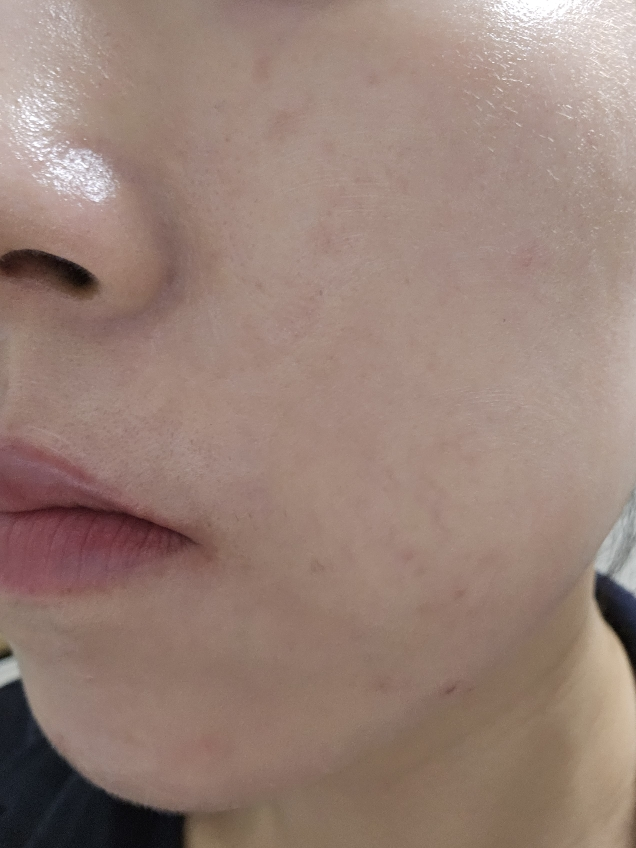 시드물 (SIDMOOL) 덕만이 무기자차 썬크림 [SPF50+/PA++++] review image