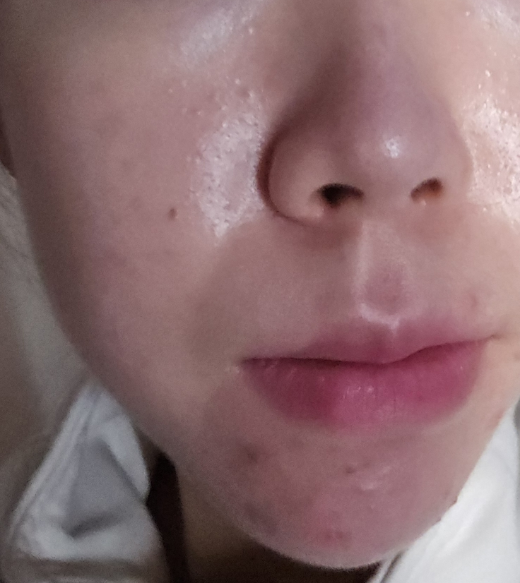 마일드랩 (mildlab) 5GF 리프티날 크림 review image