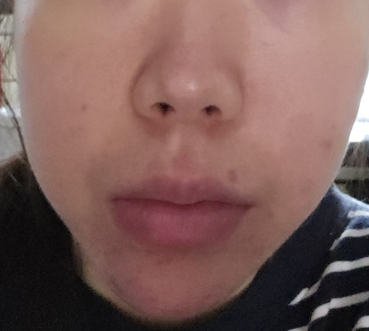 마일드랩 (mildlab) 5GF 리프티날 크림 review image