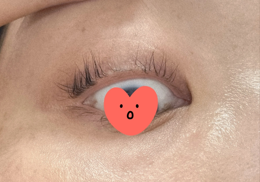 리필드 (Refilled) 사이토카인 아이래쉬 듀얼 앰플 review image