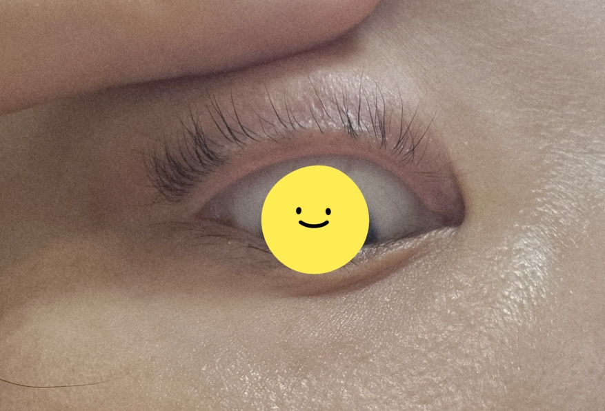 리필드 (Refilled) 사이토카인 아이래쉬 듀얼 앰플 review image