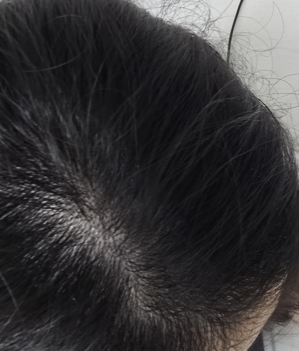 头皮护理荷荷巴茶树洗发水的真实用户使用照片