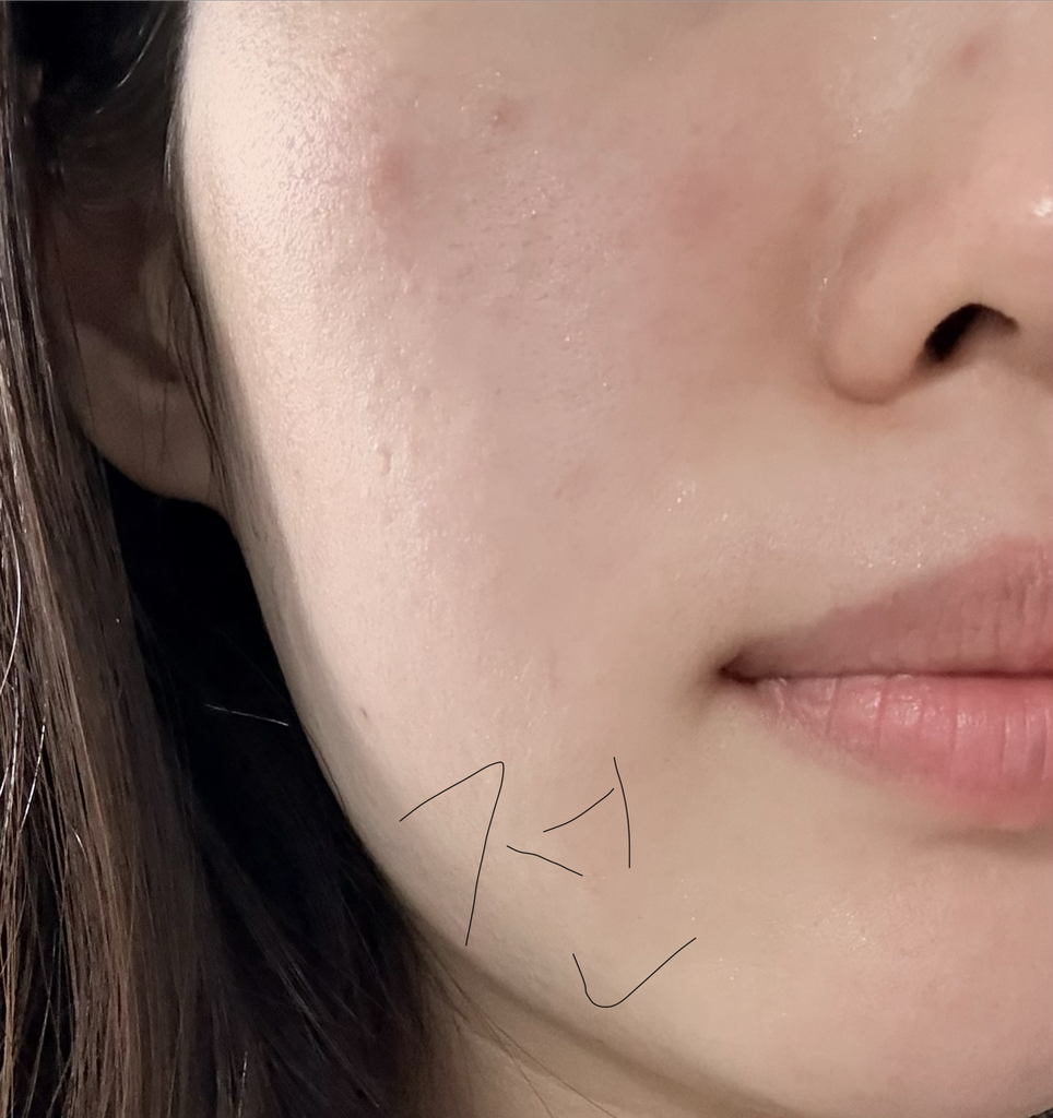 더마토리 (DERMATORY) 밴드 마스크 [프로시카징크덤] review image