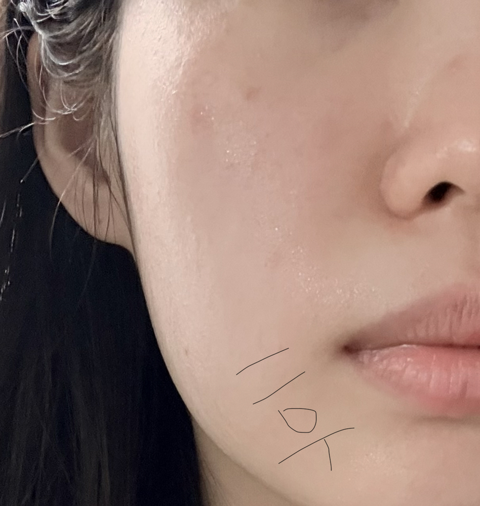 더마토리 (DERMATORY) 밴드 마스크 [프로시카징크덤] review image