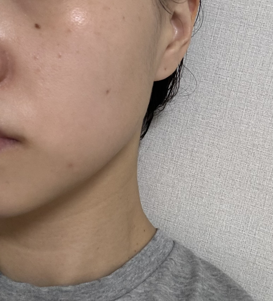유이크 (UIQ) 바이옴 베리어 파하 결 앰플 review image