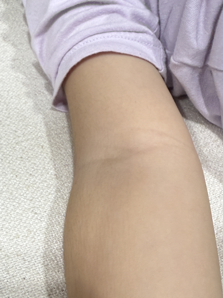 泛醇乳膏的真实用户使用照片