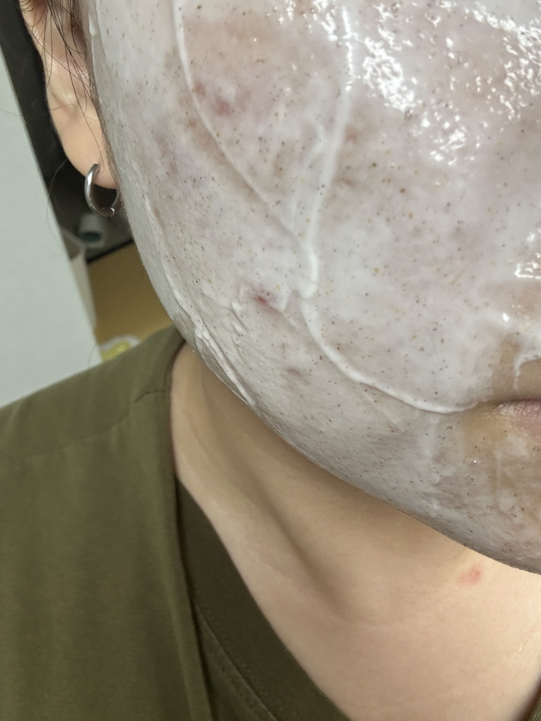 Ảnh đánh giá thực tế của người dùng về Chalttteok Pep Pore Reset Pack Cleanser