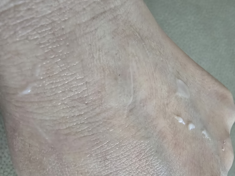 듀이트리 (DEWYTREE) AC 딥 장벽 진정 크림 review image