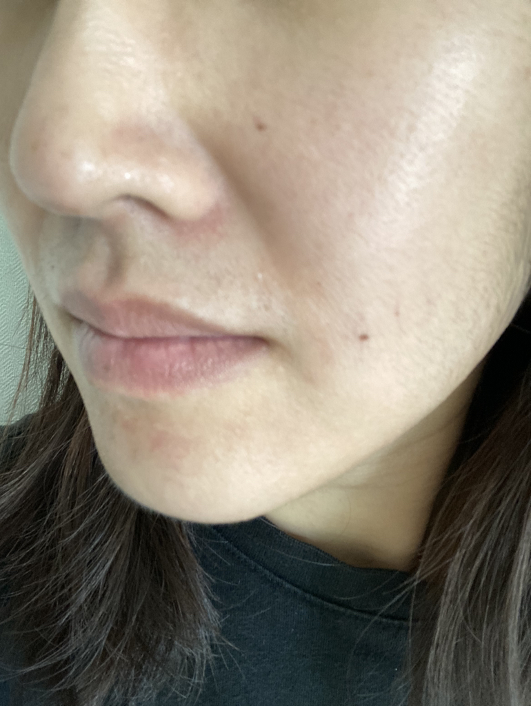 메디필 (MEDIPEEL) 히알루론산 레이어 물톡스 토너 review image
