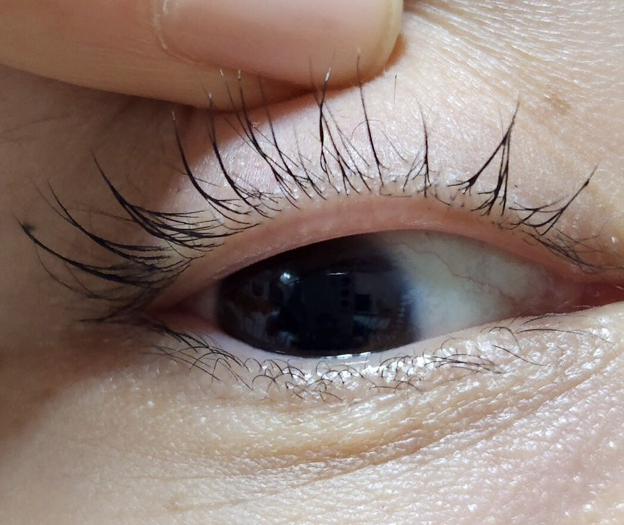 리필드 (Refilled) 사이토카인 아이래쉬 듀얼 앰플 review image