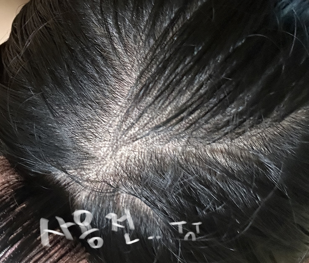 바이브랩 (ViveLab) 리바이 솔루션 안티 헤어 로스 스칼프 샴푸 review image