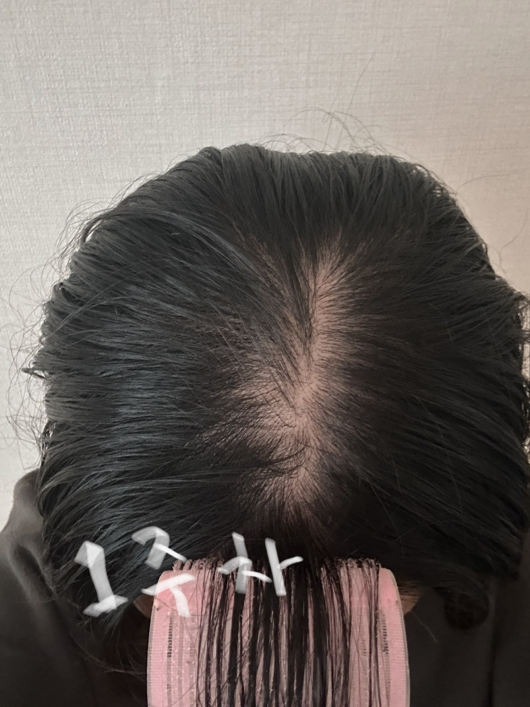 바이브랩 (ViveLab) 리바이 솔루션 안티 헤어 로스 스칼프 샴푸 review image