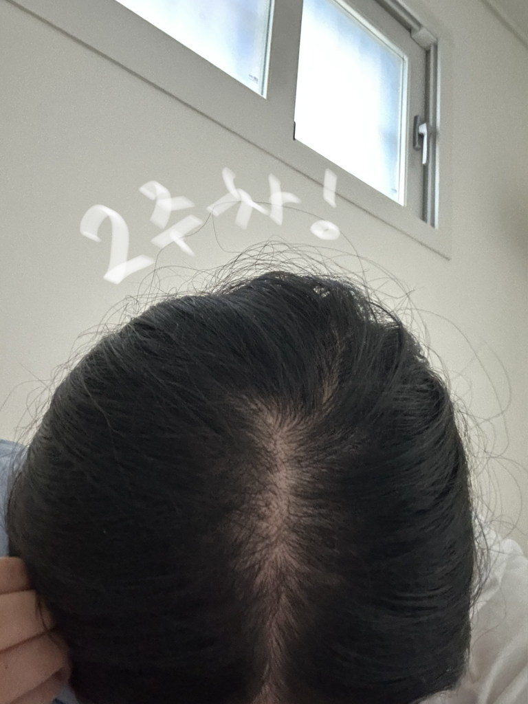 바이브랩 (ViveLab) 리바이 솔루션 안티 헤어 로스 스칼프 샴푸 review image