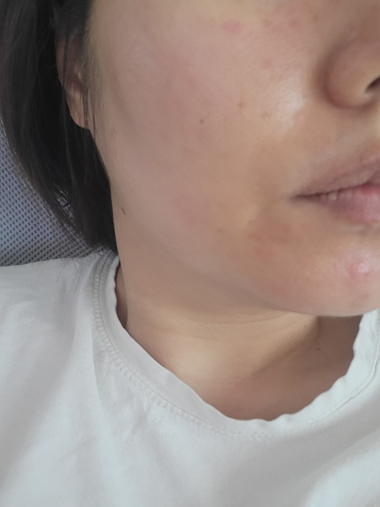 鱼腥草面膜的真实用户使用照片