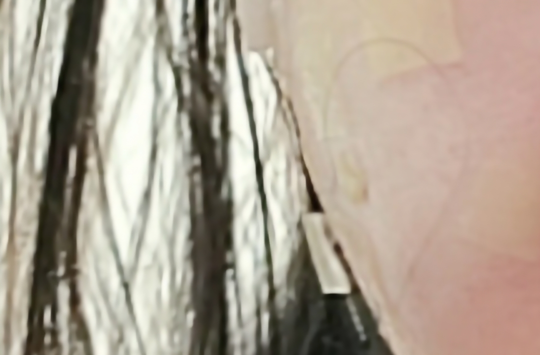 红斑护理贴片套装 [红斑］的真实用户使用照片