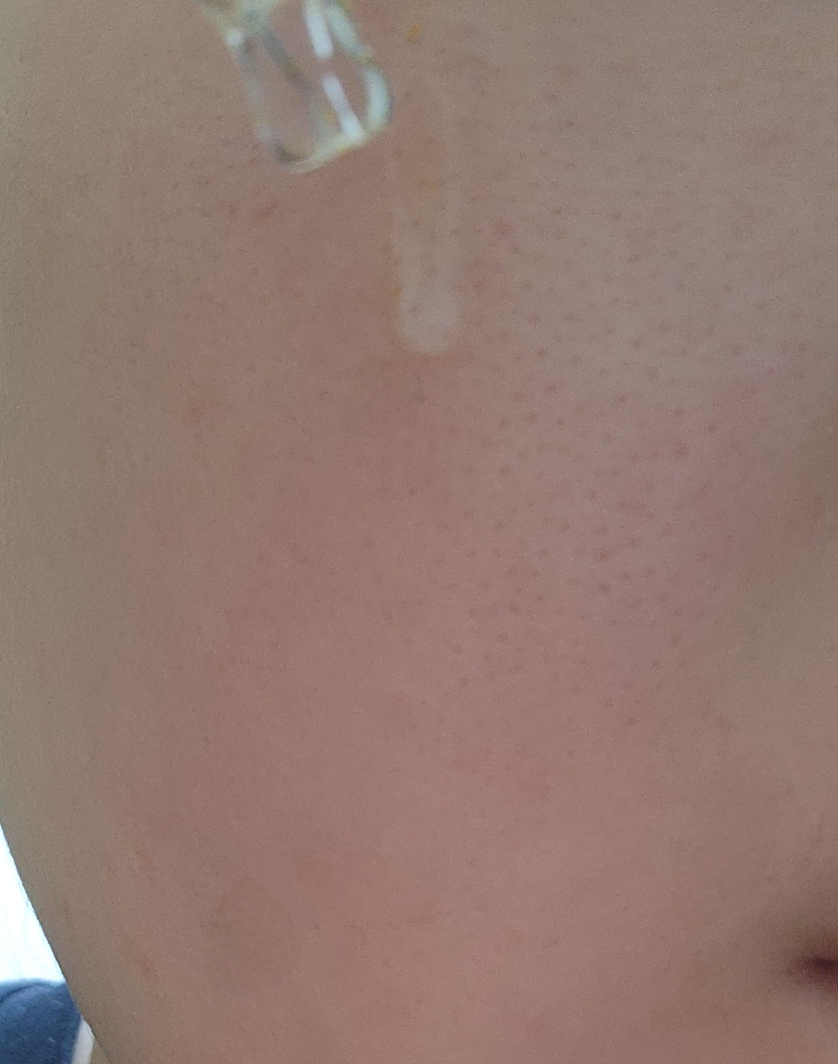 이니스프리 (INNISFREE) 비타민C 캡슐 세럼 review image