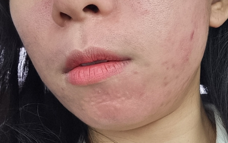 关于音调 肤层紧致粉底液 [SPF30/PA++] [22 象牙色］ common.review image