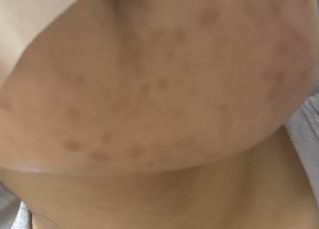 더마팩토리 (DERMAFACTORY) 레티날 300ppm 크림 review image