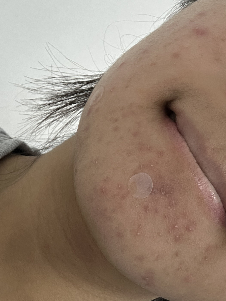 马蹄草红斑霜的真实用户使用照片