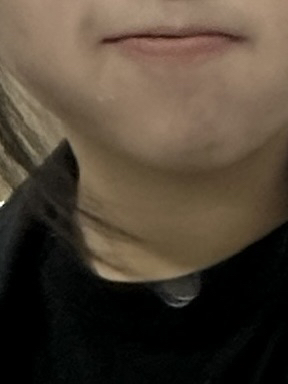 马蹄草红斑霜的真实用户使用照片