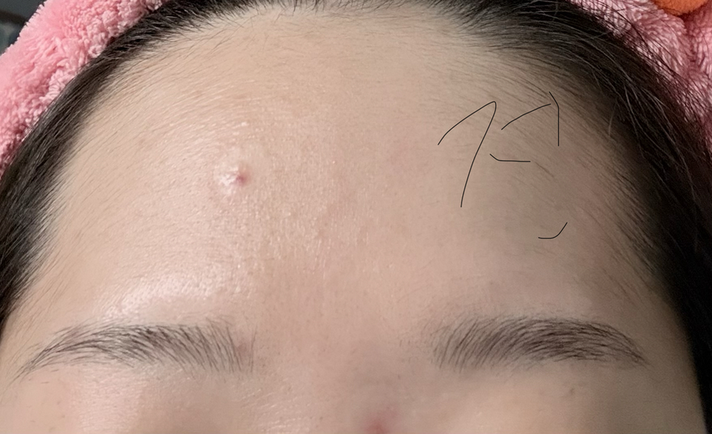 메디필 (MEDIPEEL) 피토 시카놀 B5 카밍 비건 랩핑 마스크 review image