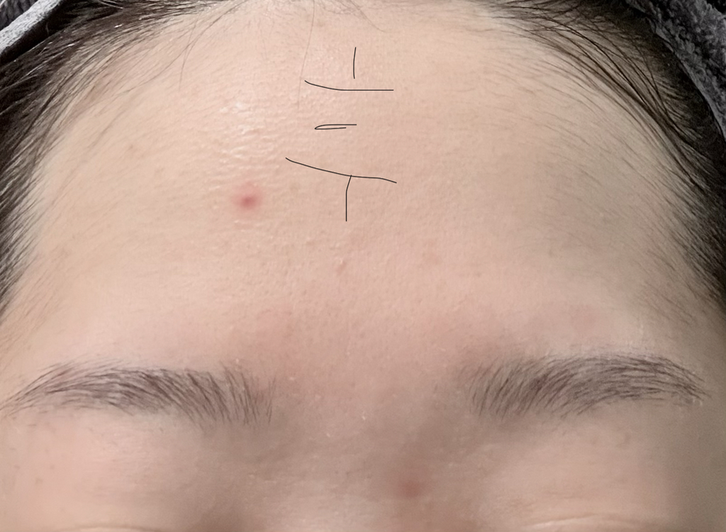 메디필 (MEDIPEEL) 피토 시카놀 B5 카밍 비건 랩핑 마스크 review image