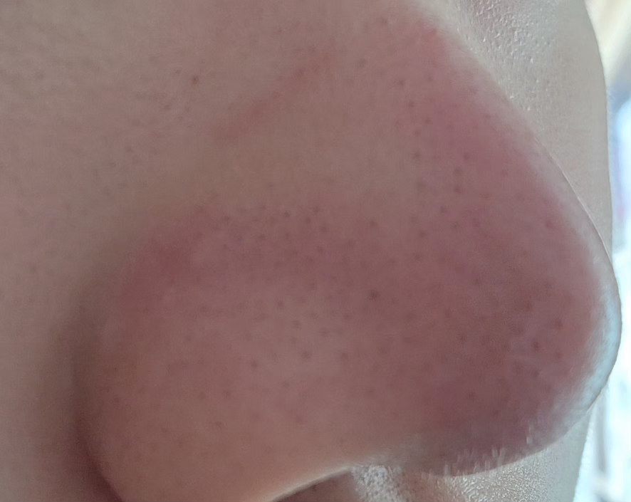 비플레인 (beplain) 녹두 모공 스케일링 워터 review image