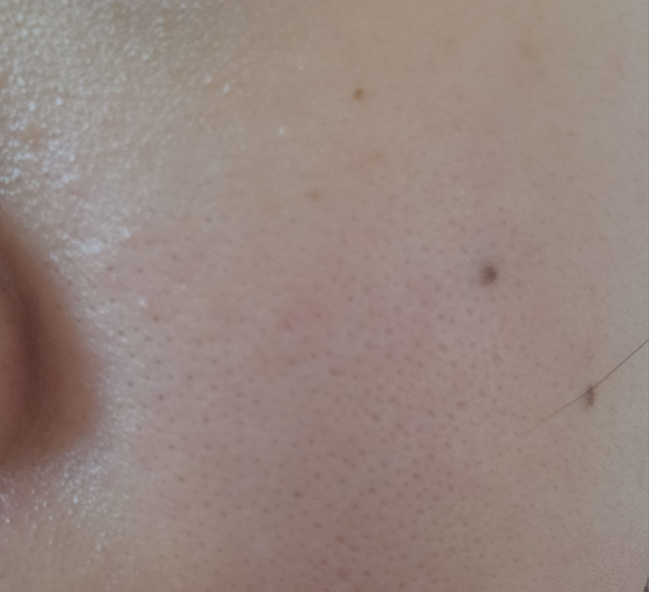 닥터나인틴 (Dr.nineteen) 포어엑스좀 콜라부스터 포어샷 크림 review image