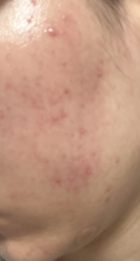 舒缓凝胶 [97% 芦荟成分］的真实用户使用照片