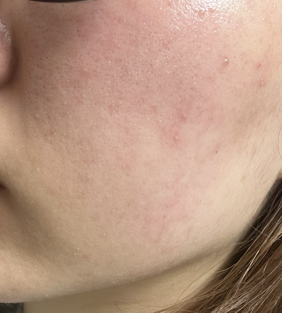 舒缓凝胶 [97% 芦荟成分］的真实用户使用照片